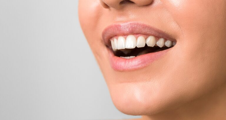 Frau mit weißen Zähnen