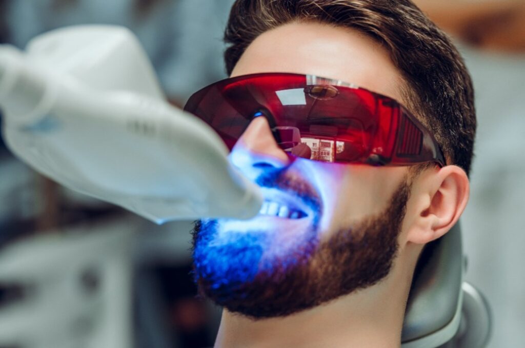 Ein Mann bekommt eine Zahnaufhellung mit einem UV-Zahnaufhellungsgerät. Die Augen sind durch eine Schutzbrille geschützt.